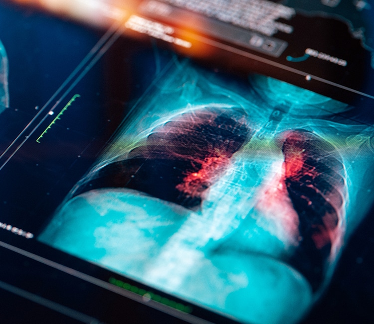 the-dangers-of-asbestos-02